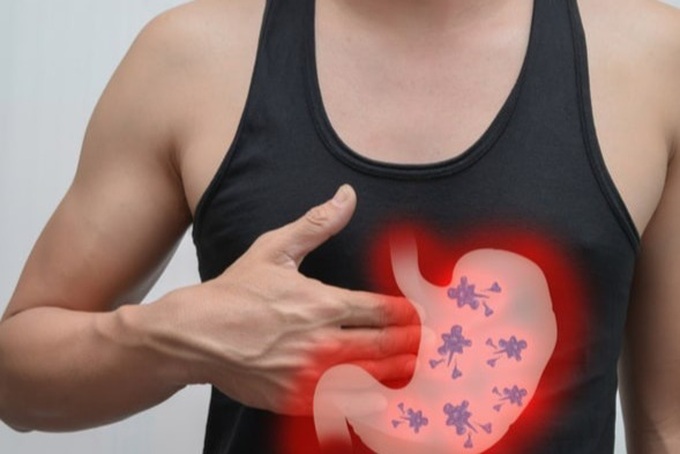 Tỷ lệ sống sau 5 năm với ung thư dạ dày giai đoạn 2
