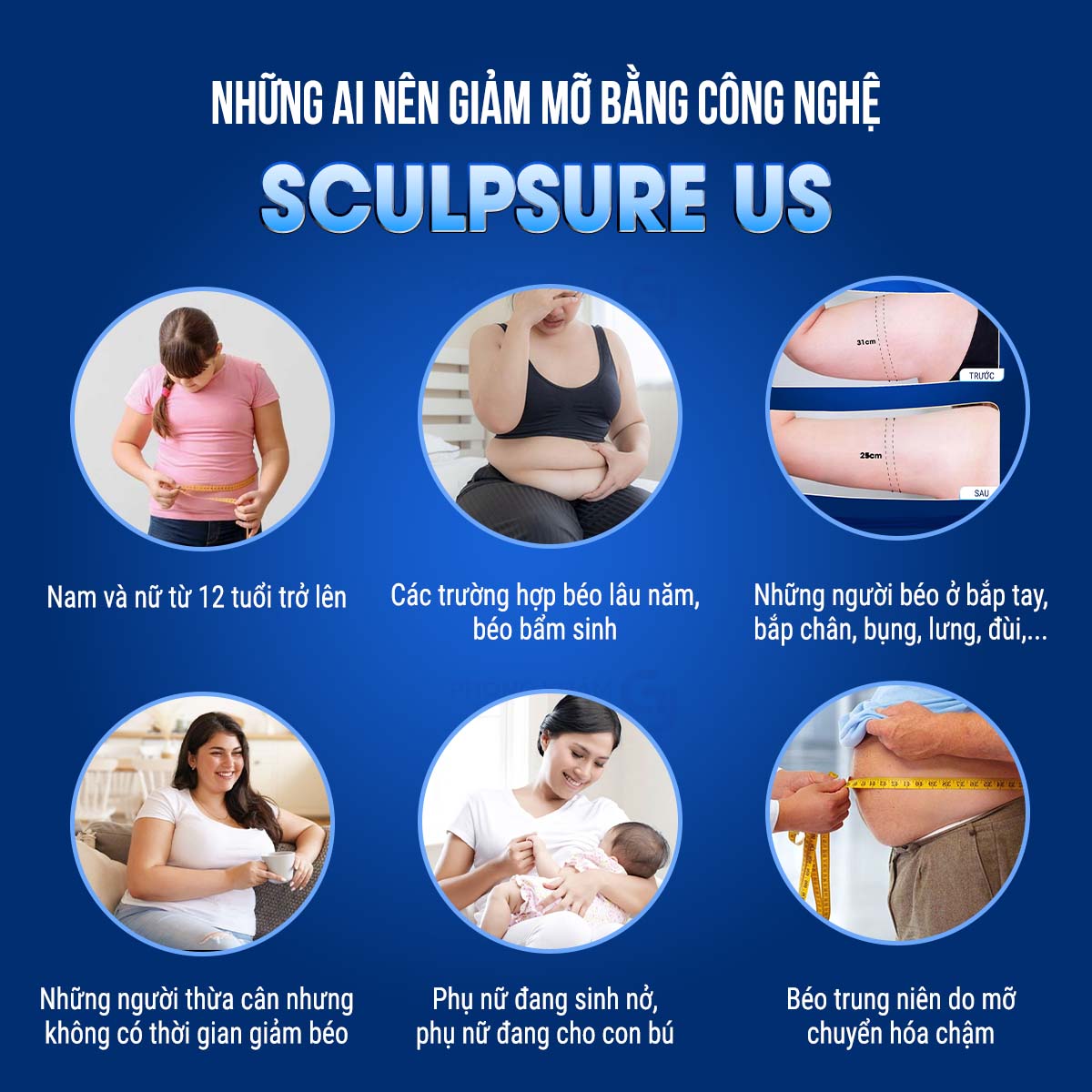 GIẢM MỠ KHÔNG XÂM LẤN VỚI CÔNG NGHỆ HÀNG ĐẦU HÀN QUỐC SCULPSURE US