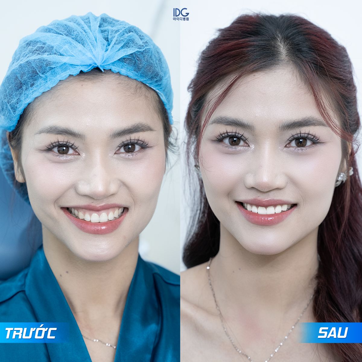 A collage of women with a blue cap and hair netAI-generated content may be incorrect.